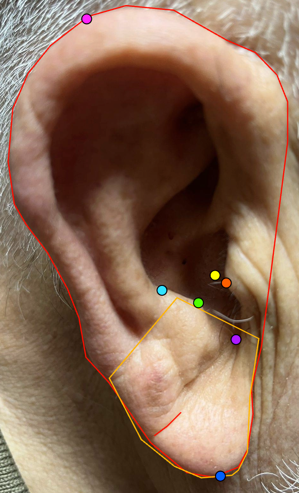 AI analizli kulak memesi görüntüsü